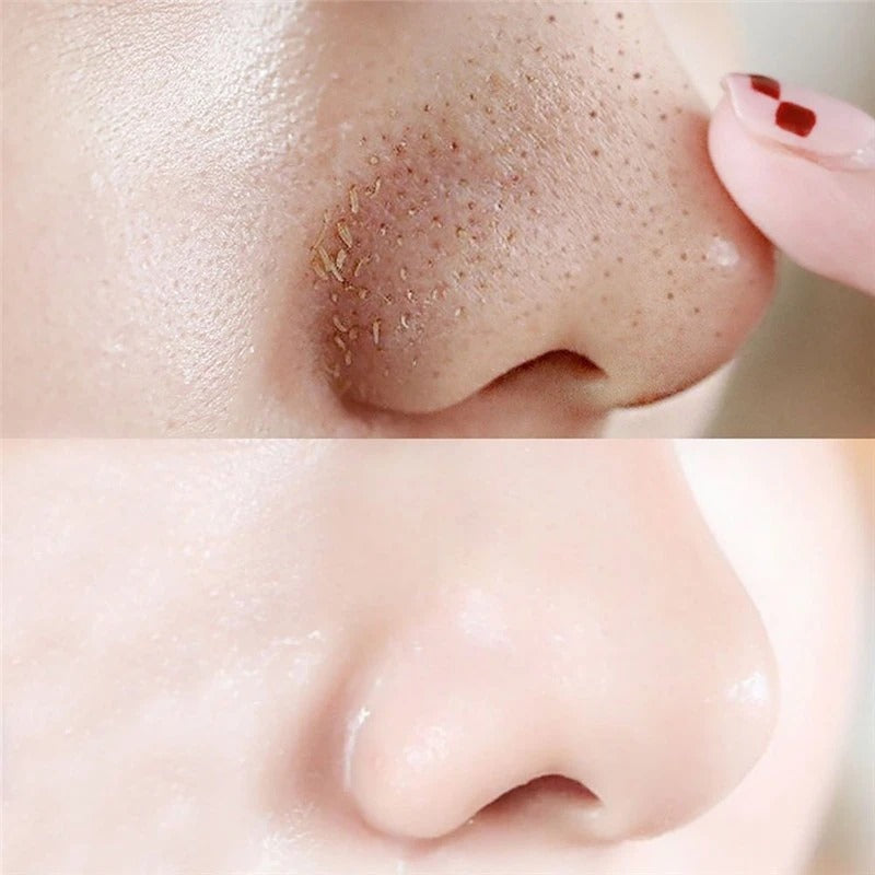 Charcoal Blackhead Remover Nose Strips