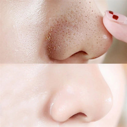 Charcoal Blackhead Remover Nose Strips